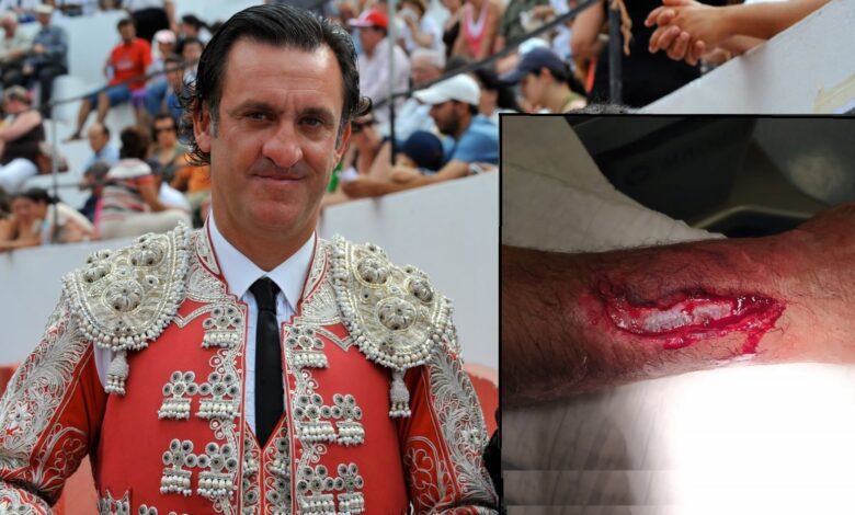 Bandarilheiro tomarense ferido durante espetáculo taurino bandar 7714083 6990771951048327168 n