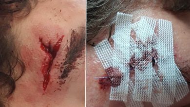 Caso de violência entre alunos numa escola em Abrantes ab 18484991635078726 6038056114250005399 n