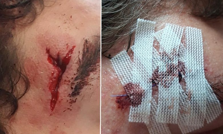 Caso de violência entre alunos numa escola em Abrantes ab 18484991635078726 6038056114250005399 n