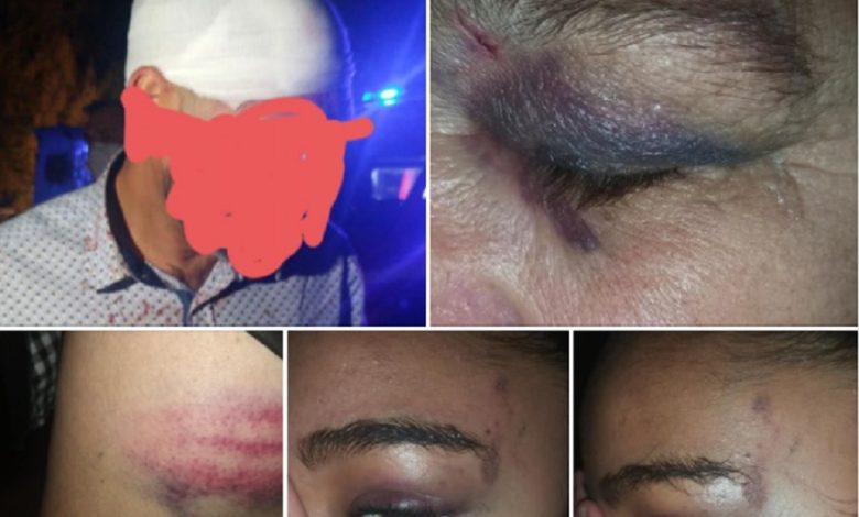 Moradores do Flecheiro acusam polícia de violência flecheiro ciganos psp