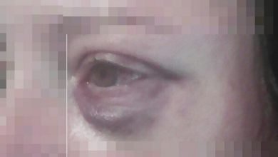 agresssao violencia IMG 20210426 112414 Copia