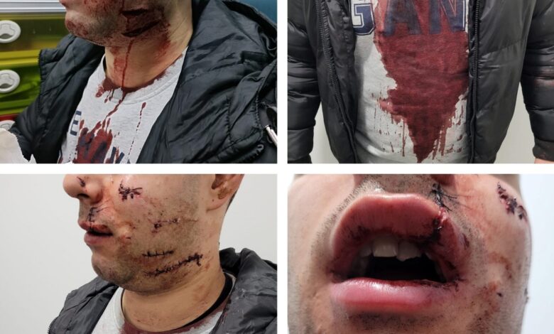 Militar da GNR agredido com violência em Tomar (imagens fortes) viol disco gnr