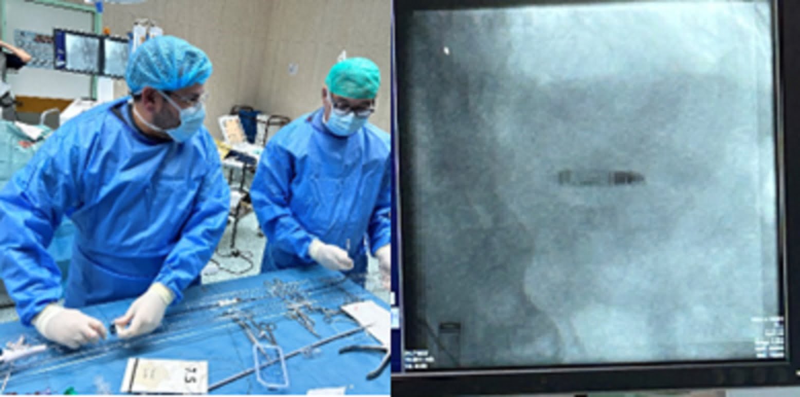 CHMT Cardiologia Abrantes 3